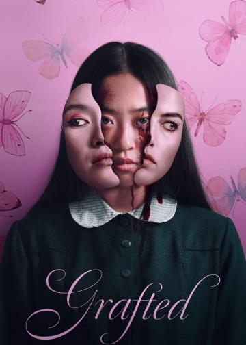 移植
